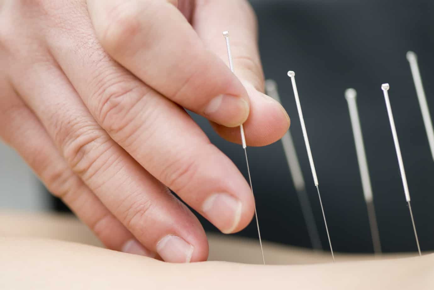 Acupuncture Services and Fort Collins Chriropractic Care